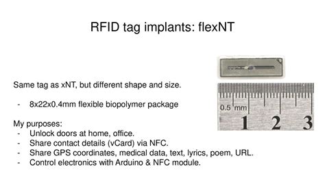 xnt rfid tag|xnt chip implants.